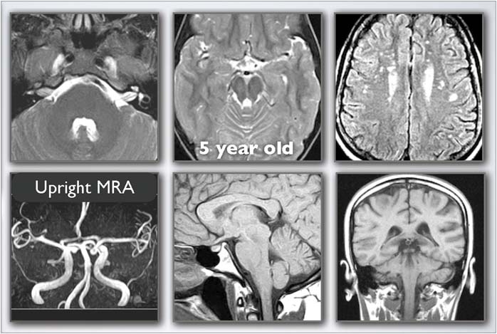 High-Resolution-Neuroimaging